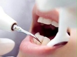 洗牙后为何会变得脆弱？可能是你没有护理好！