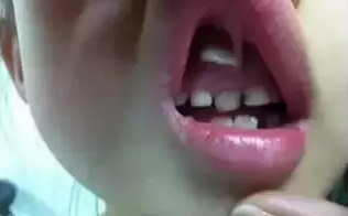 乳牙