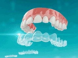 牙齿纠正后会对口腔发生什么影响